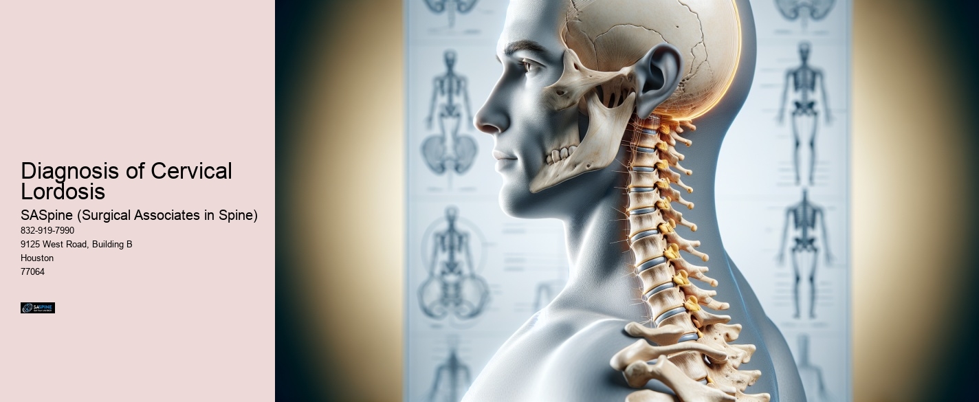Diagnosis of Cervical Lordosis