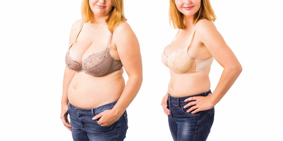 loose skin after weight loss surgery